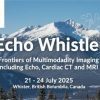 Mayo Clinic Echo Whistler Frontiers of Multimodality Imaging Including Echo, Cardiac CT and MRI 2025